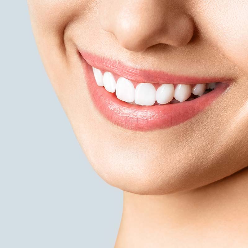 Tannhvíttun hjá Clinica